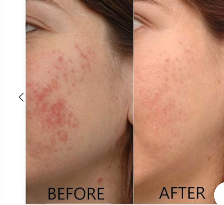 سرم ویتامین سی 8% و آلفا آربوتین 2% اوردینری | The Ordinary Ascorbic Acid 8% + Alpha Arbutin 2%