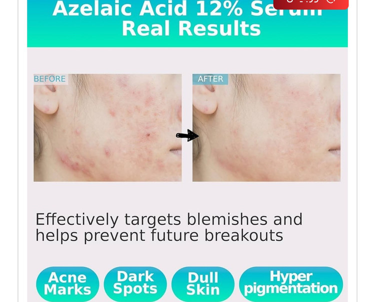 سرم آزلائیک اسید 16% مدیکیوب | Medicube Azelaic Acid 16 Calming Serum