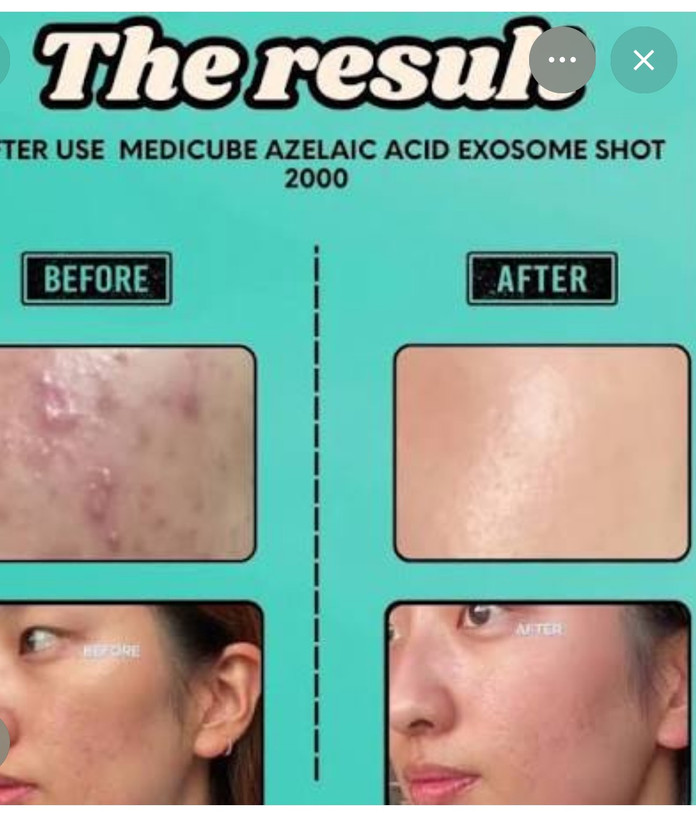سرم آزلائیک اسید 16% مدیکیوب | Medicube Azelaic Acid 16 Calming Serum