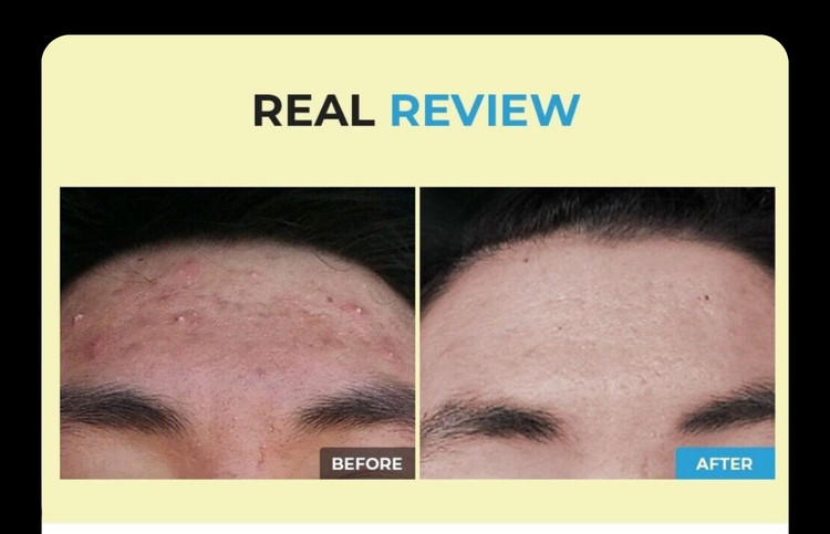 ژل شستشوی گود مورنینگ کوزارکس | شوینده pH پایین